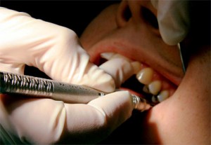 health care provider working on teeth