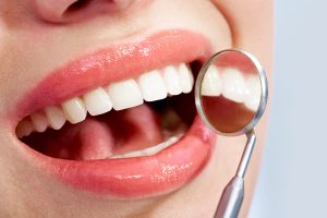 Caution required when discussing associations between oral and overall health