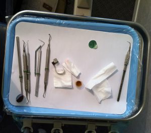 Reporter shares insights on covering cuts to Medicaid dental coverage