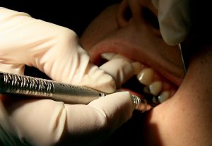Advocates for dental therapists launch partnership