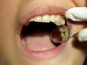 White paper calls for more attention to endodontic oral care