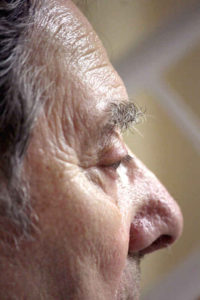 Biogen submits BLA for an Alzheimer’s drug with a controversial past