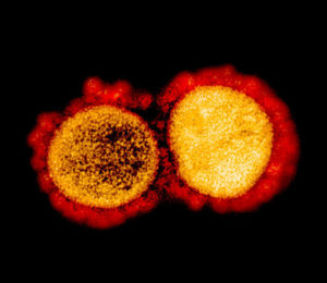 Transmission electron micrograph of SARS-CoV-2 virus particles, isolated from a patient.