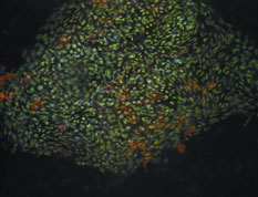When stem cells like these human embryonic stem cells divide, each new cell has the potential to remain a stem cell or become a cell with a more specialized function, such as a muscle cell or a red blood cell. Photo: National Institutes of Health