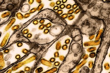 avian influenza (bird flu) virus particles under a microscope