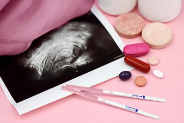 an ultrasound, pregnancy tests and supplements for reproductive health