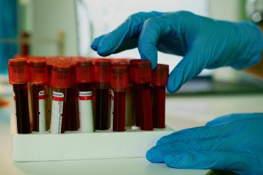 blood biomarker test