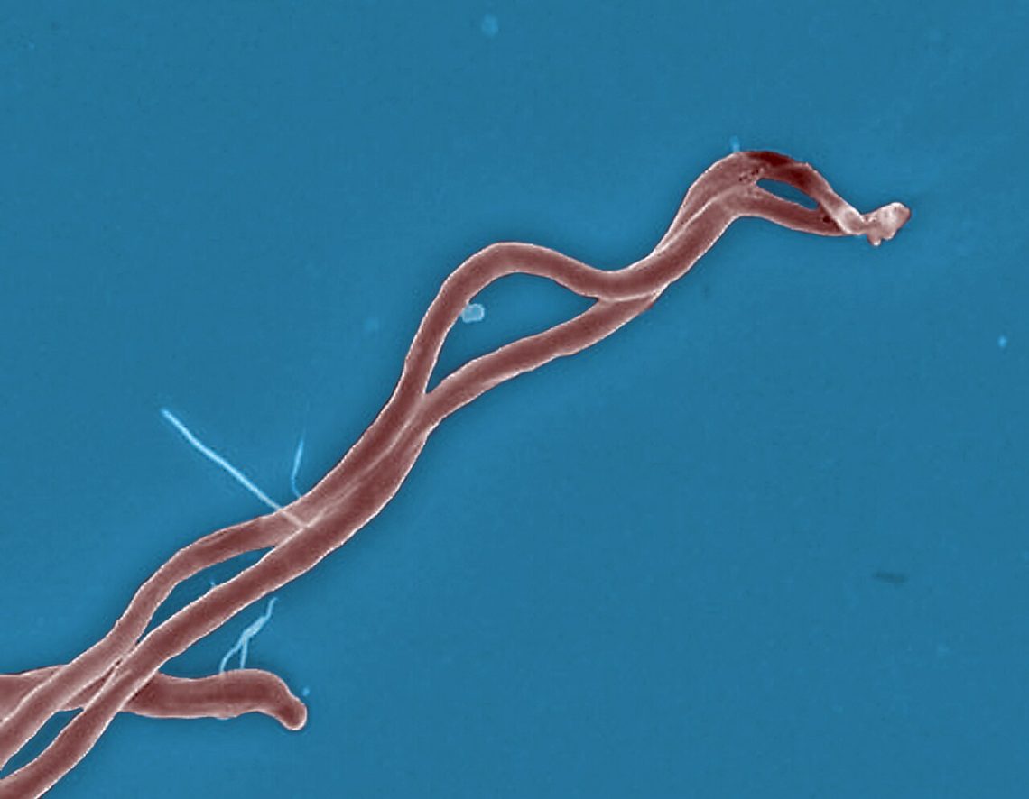 Lyme disease is changing in a warming world — and so should the news 