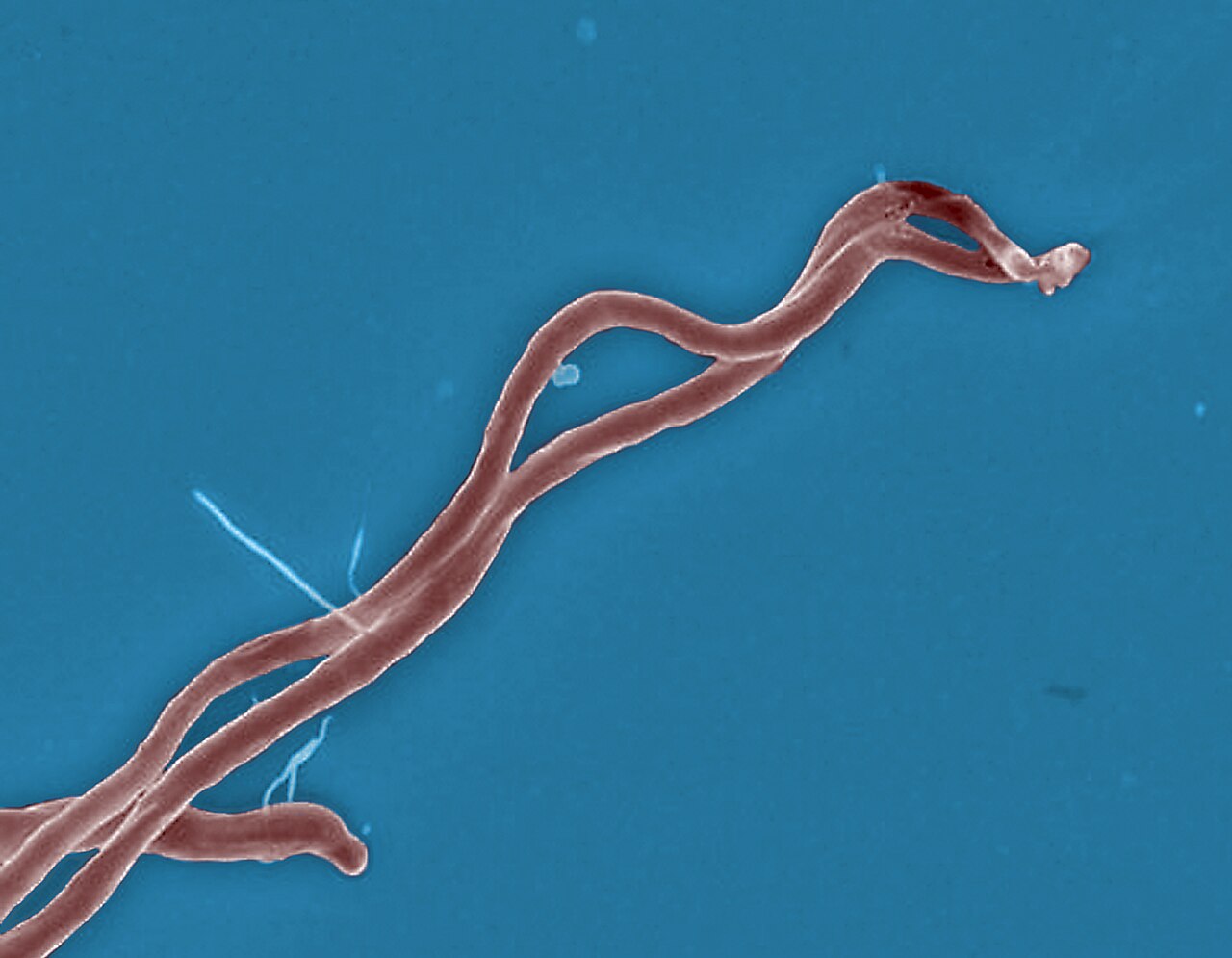 Lyme disease bacteria