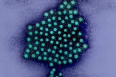 Colorized micrograph of hepatitis A virus particles. Photo by NIAID (CC BY 2.0)
