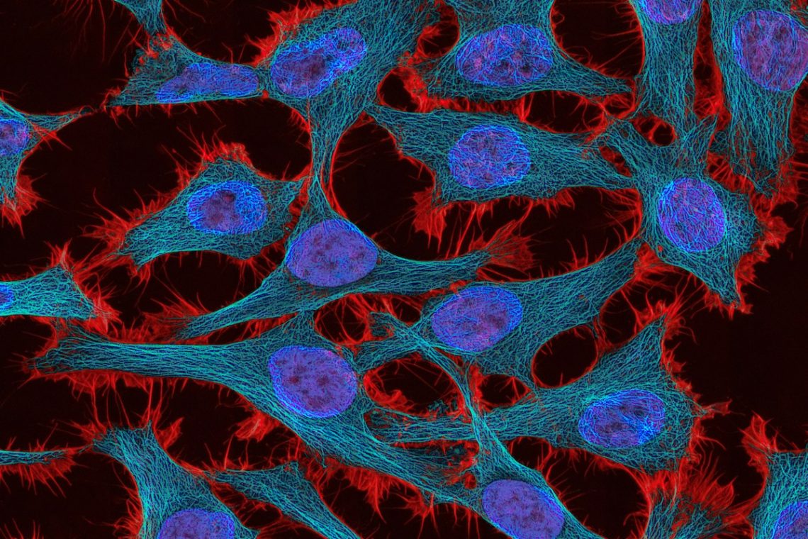 Will at-home screening methods for cervical cancer impact patient health?