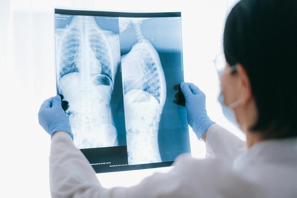 A doctor holding up an x-ray. In a new study, only 41% of radiologists were able to notice that an x-ray was AI-generated.