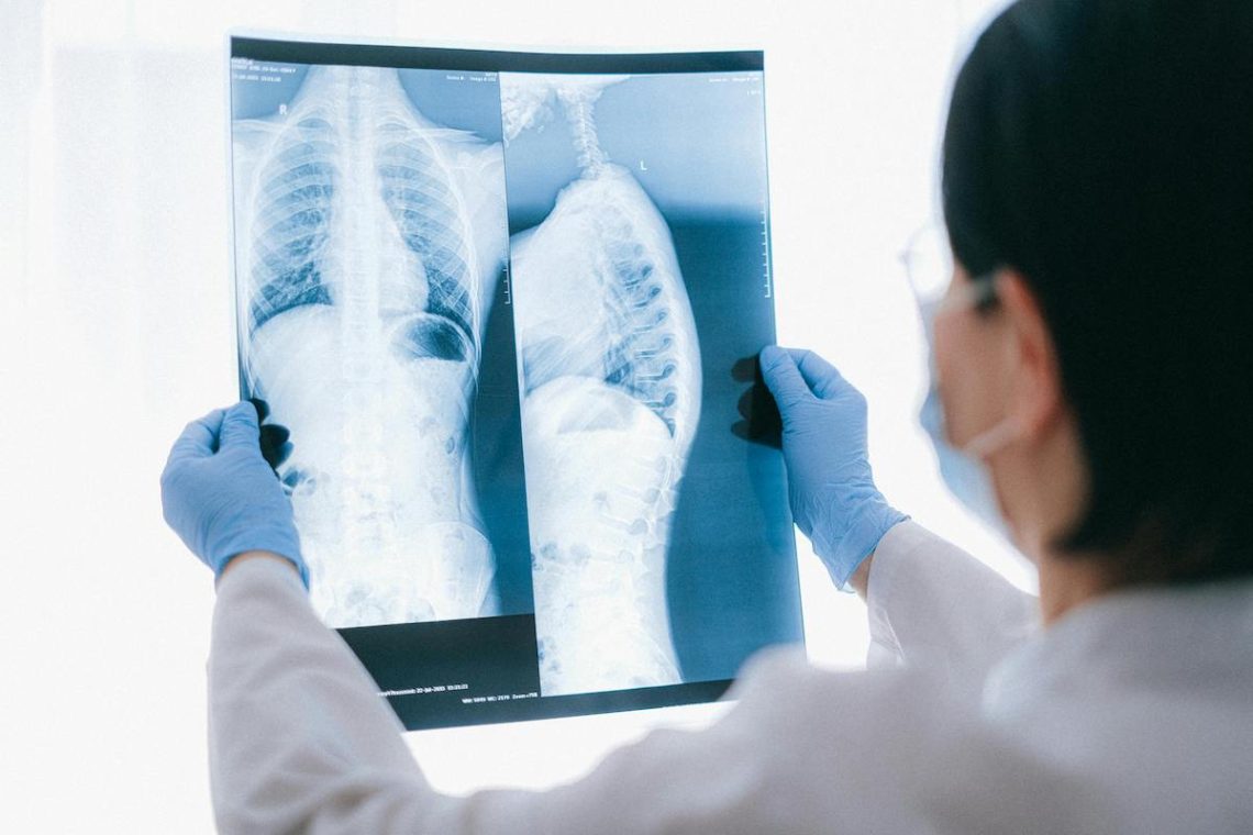 AI-generated X-rays stump radiologists: What does it mean for patient safety?