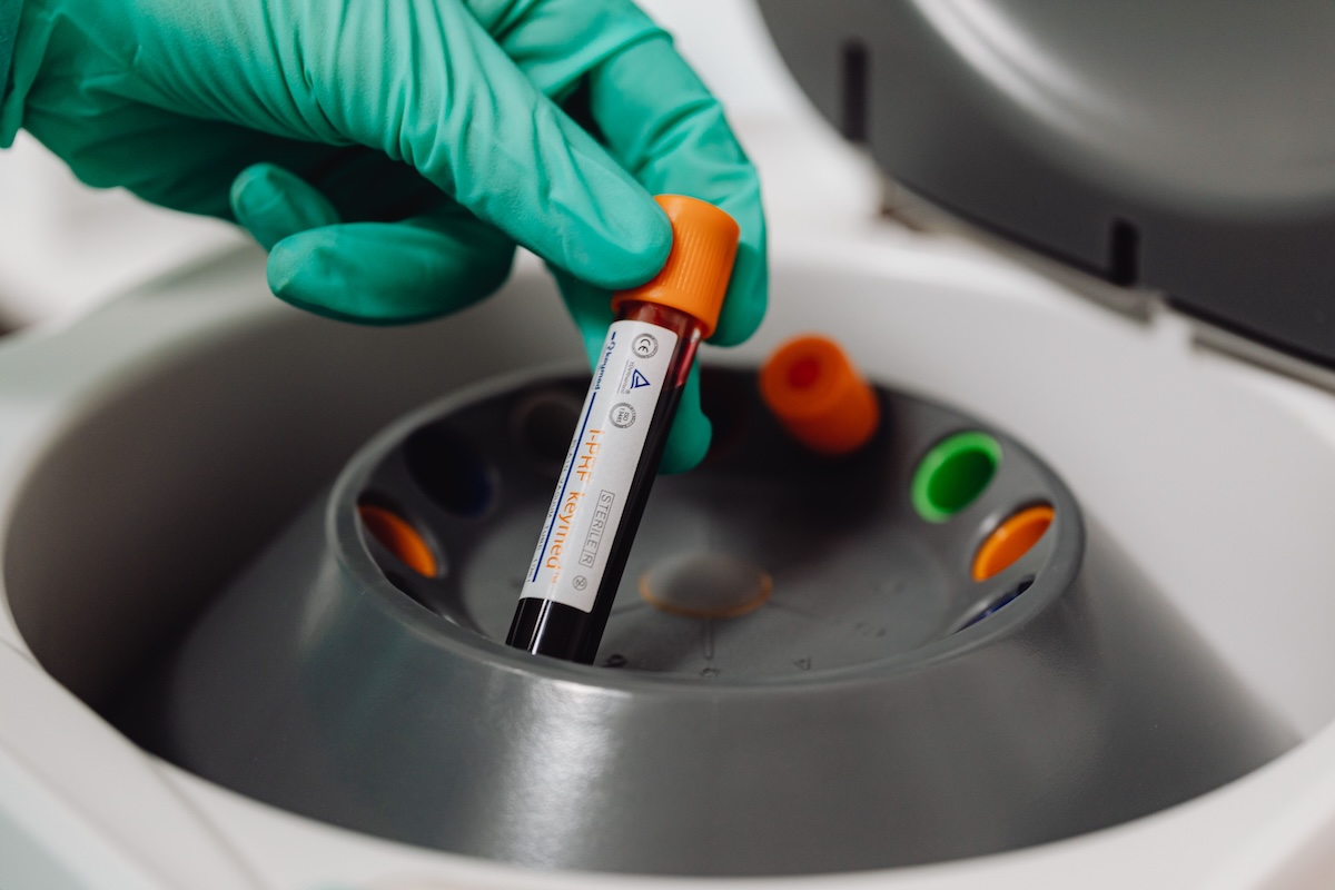 a blood test tube in a centrifuge, similar to the Alzheimer's drug blood test