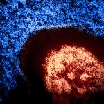 Colorized transmission electron micrograph of a measles virus particle (red). Microscopy is courtesy CDC; layout, colorization, and visual effects by NIAID. Credit: CDC and NIAID