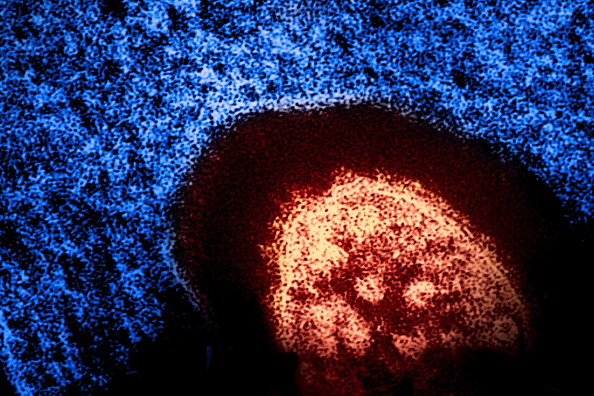 Colorized transmission electron micrograph of a measles virus particle (red). Microscopy is courtesy CDC; layout, colorization, and visual effects by NIAID. Credit: CDC and NIAID